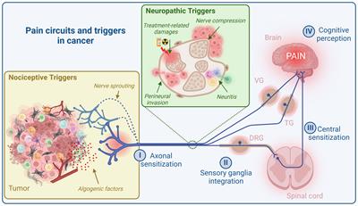 From pain to tumor immunity: influence of peripheral sensory neurons in cancer